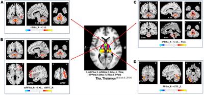 Functional connectivity impairment of thalamus-cerebellum-scratching neural circuits in pruritus of chronic spontaneous urticaria